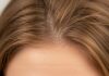 Non-Surgical Solutions for Women’s Hair Loss Women’s Hair Loss