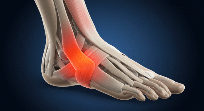 Painful Case of Plantar Fasciitis Painful Case of Plantar Fasciitis