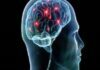 Will Levitra Help in Case of Psychological Problems? Psychological