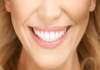 Important Considerations Before You Opt For A Smile Makeover Smile Makeover