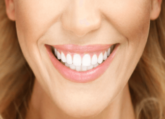 Important Considerations Before You Opt For A Smile Makeover Smile Makeover