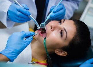 Common Misconceptions About Periodontal Disease Periodontal Disease