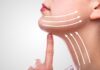 Neck Lift Procedure in Dulles, VA, For Enhancing Aesthetic Appeal and Restoring Youthfulness Neck Lift