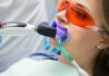 Teeth Whitening for Smokers- Challenges and Solutions Teeth Whitening