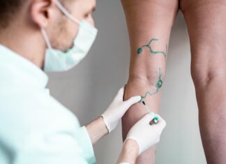 Qualities to Look for in a Vascular Surgeon Vascular Surgeon