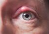 What Is Canaliculi In The Eye? Canaliculi