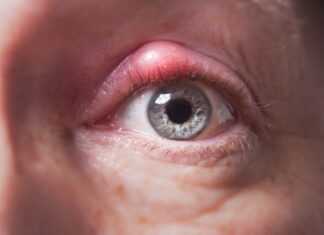 What Is Canaliculi In The Eye? Canaliculi